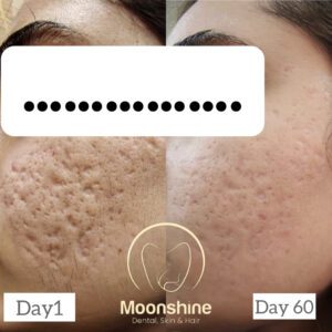 0A01CF4F-F78C-4495-9EDF-0E9F38751359